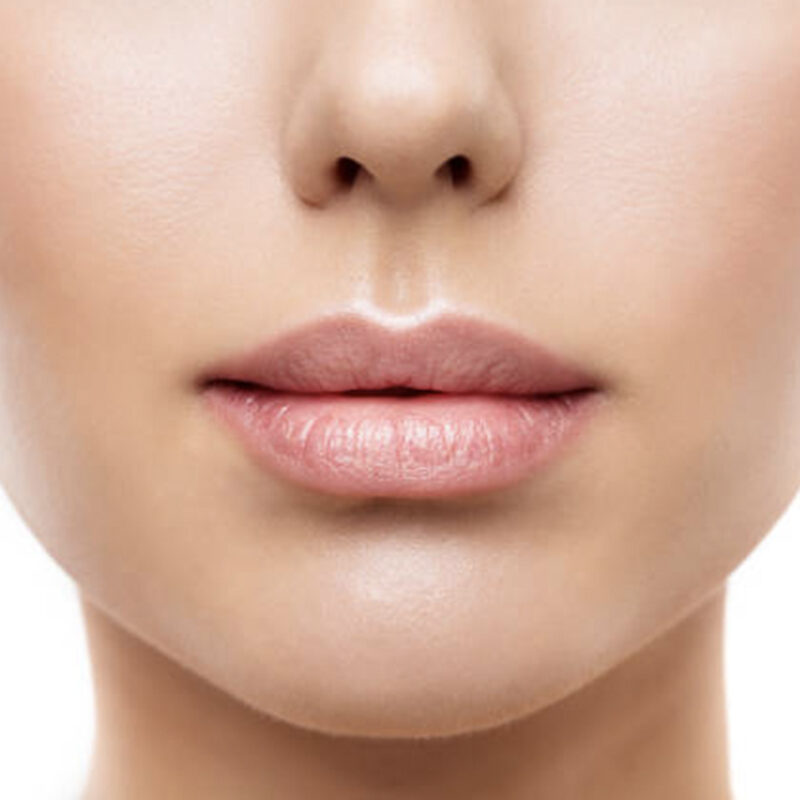 Lip Fillers Epsom Downs at Epitomi Aesthetics
