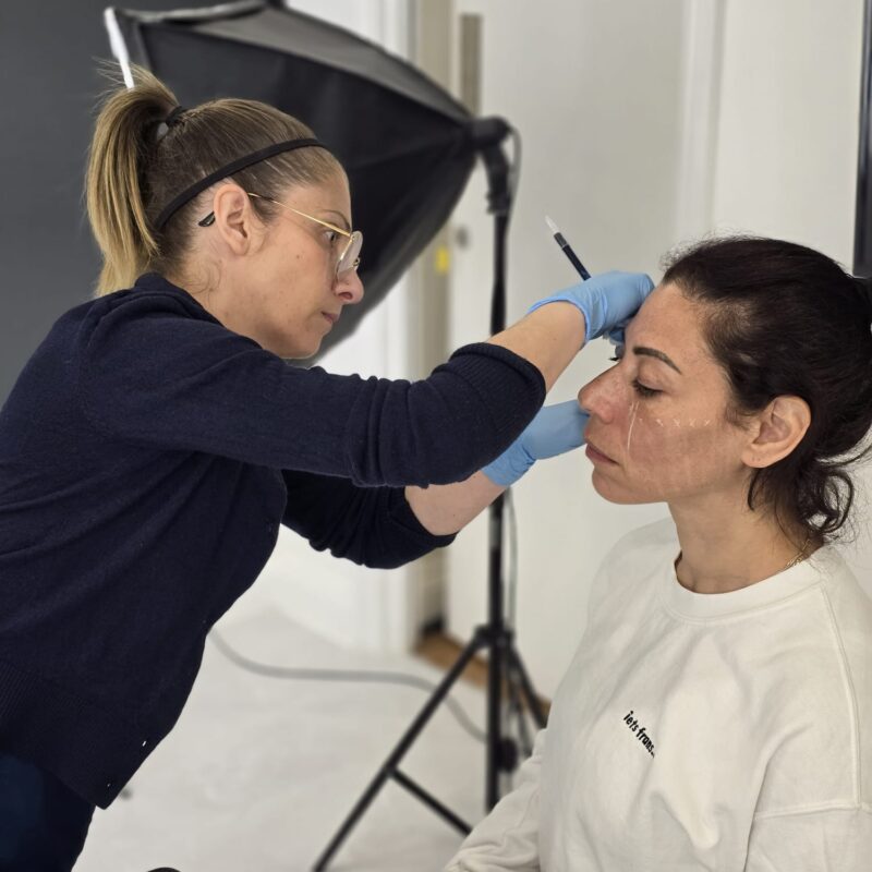 Botox anti wrinkle injections Aesthetics Treatments Epsom Downs