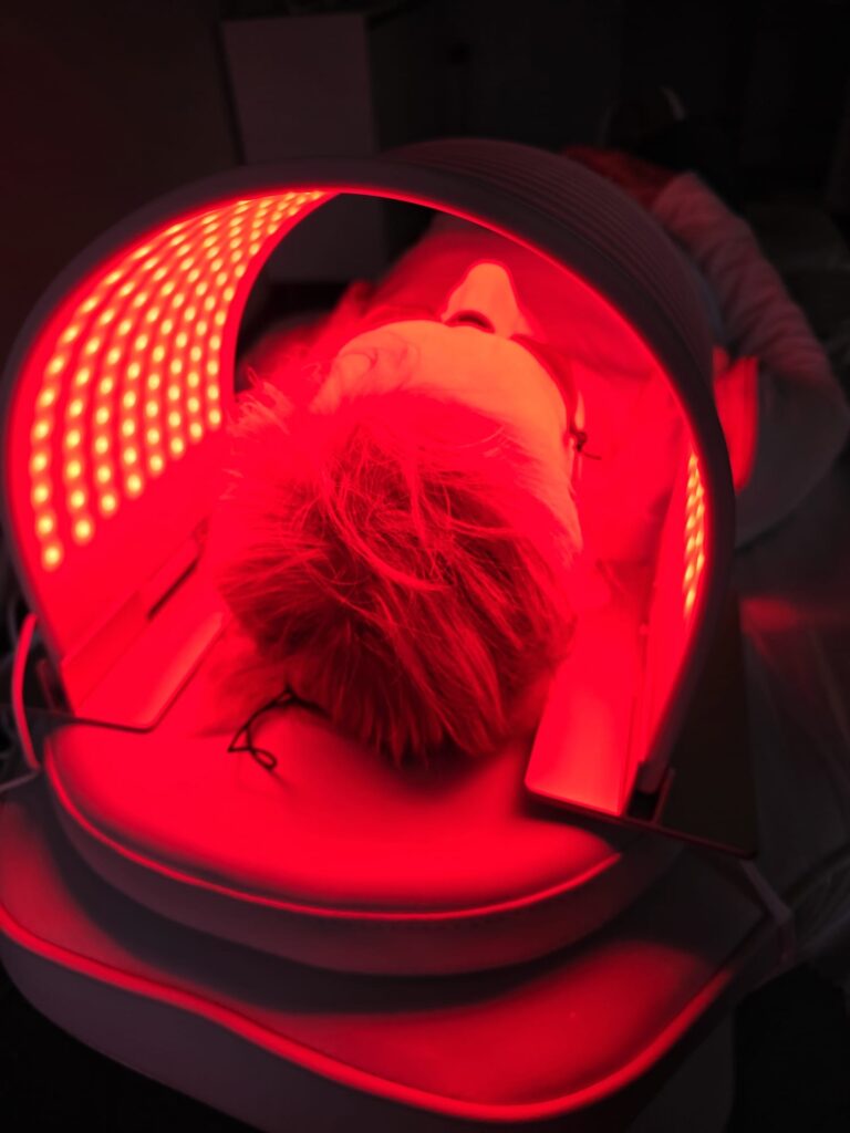 LED light therapy at Epitomi Aesthetics in Epsom, a gentle treatment used to calm rosacea-prone skin