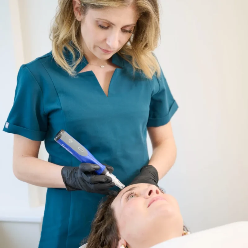 Microneedling Aftercare Epsom Downs - Epitomi Aesthetics