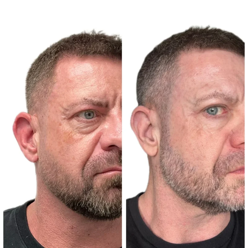 Before and after: left shows a man with short hair and fuller beard; right shows a cleaner, closely trimmed beard and neater hairline, both cropped at the shoulders and wearing a dark shirt.